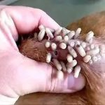 Confirma la Secretaria de Salud primera muerte por sarampión en Guerrero